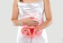 Corrimentos vaginais